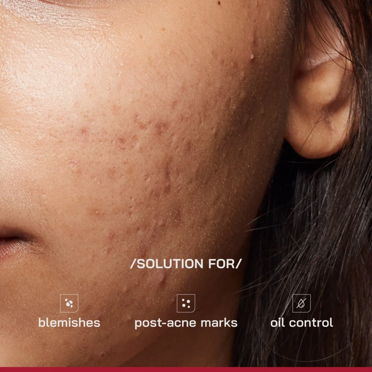 10% Niacinamide Spot Correcting Serum - Image 3
