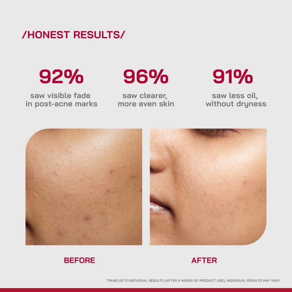 10% Niacinamide Spot Correcting Serum - Image 4
