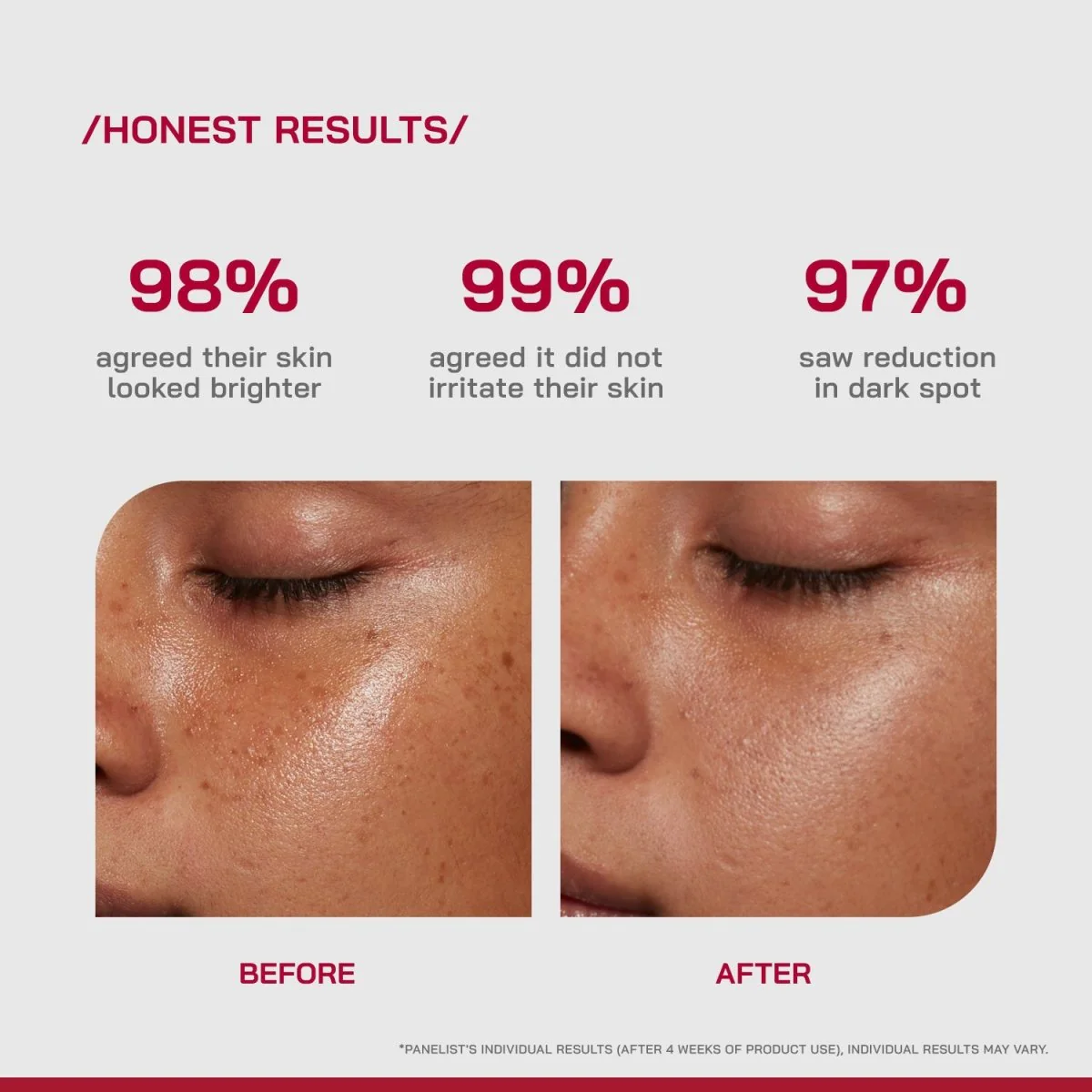 10% Vitamin C Brightening Serum - Image 4