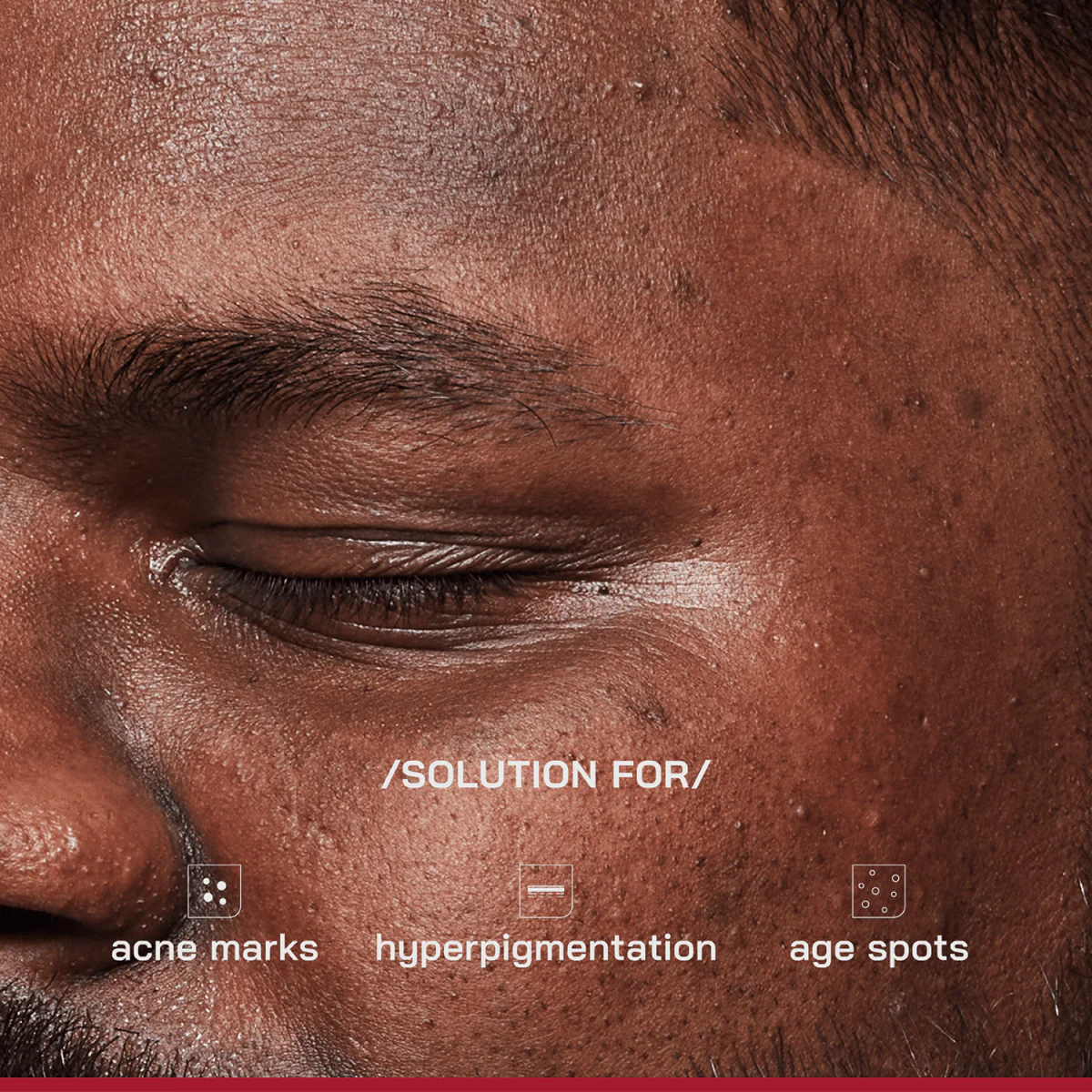 2% Alpha Arbutin Depigmentation Serum - Image 12