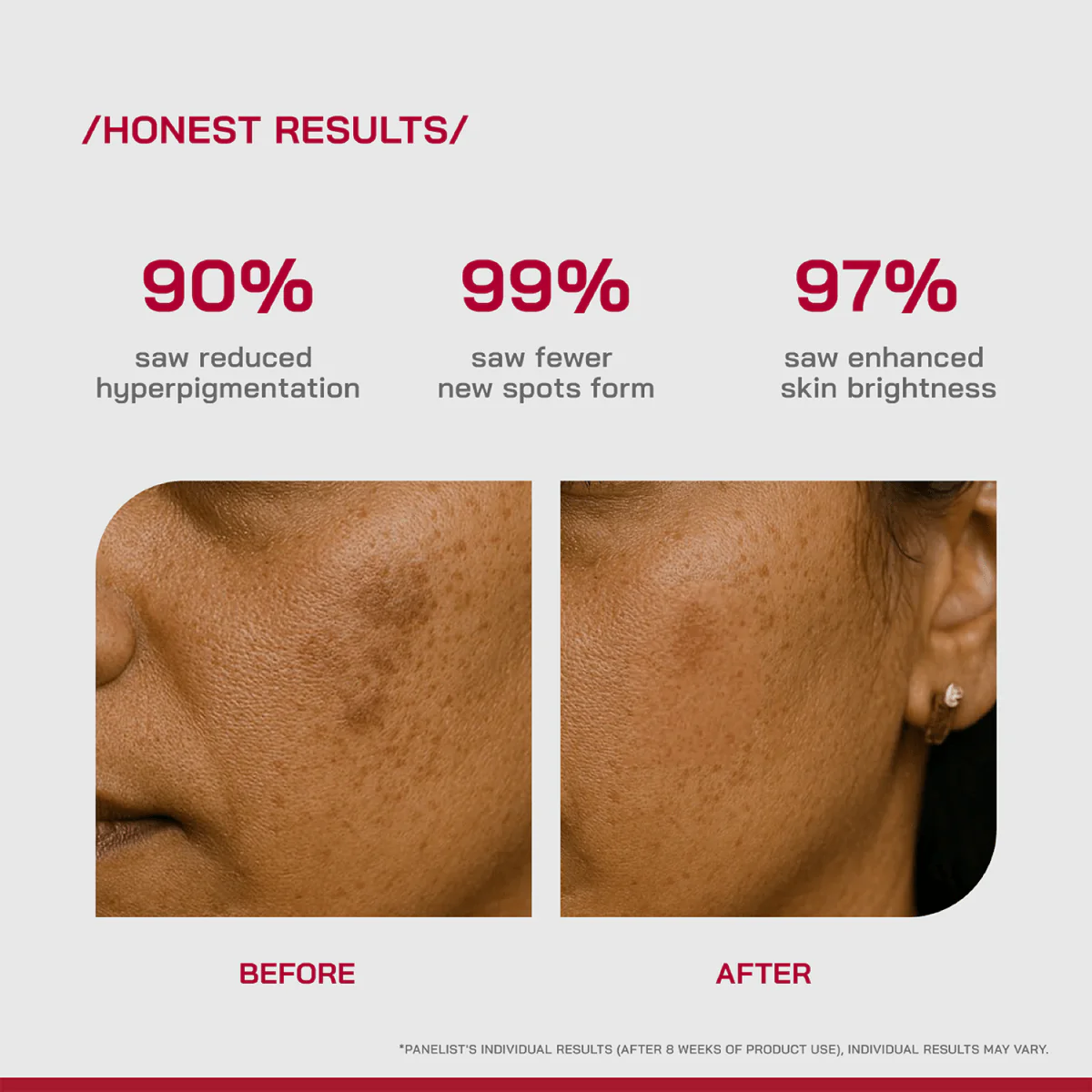 2% Alpha Arbutin Depigmentation Serum - Image 13