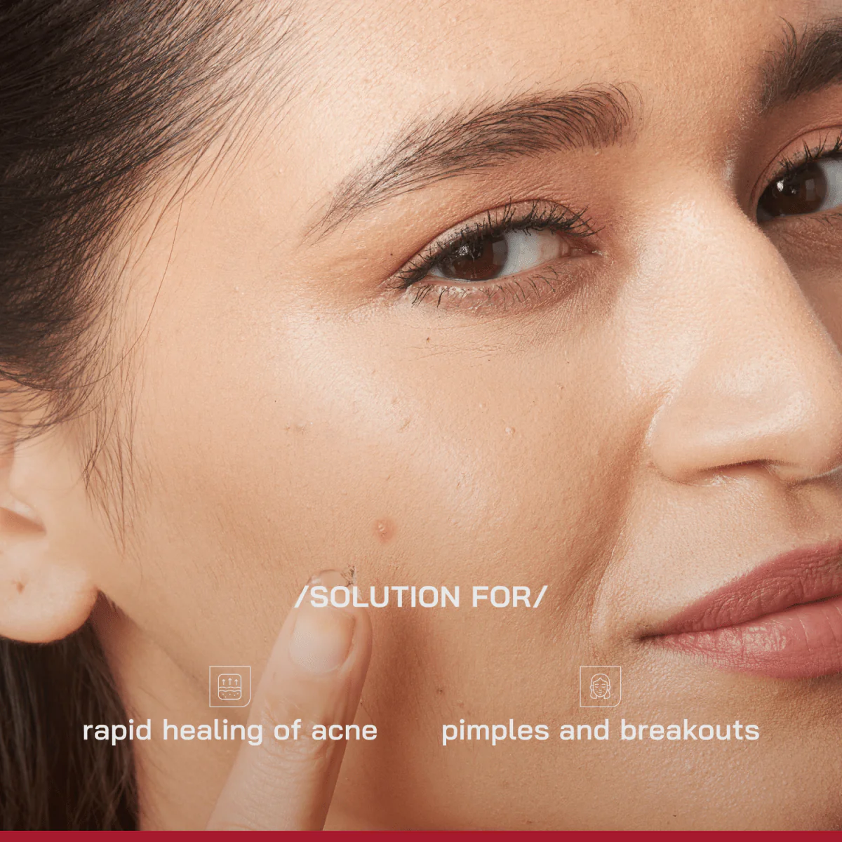 Salicylic Acid Acne Spot Treatment Gel - Image 3